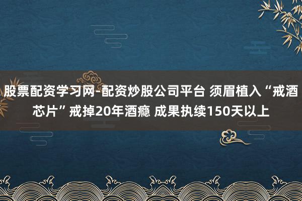 股票配资学习网-配资炒股公司平台 须眉植入“戒酒芯片”戒掉20年酒瘾 成果执续150天以上